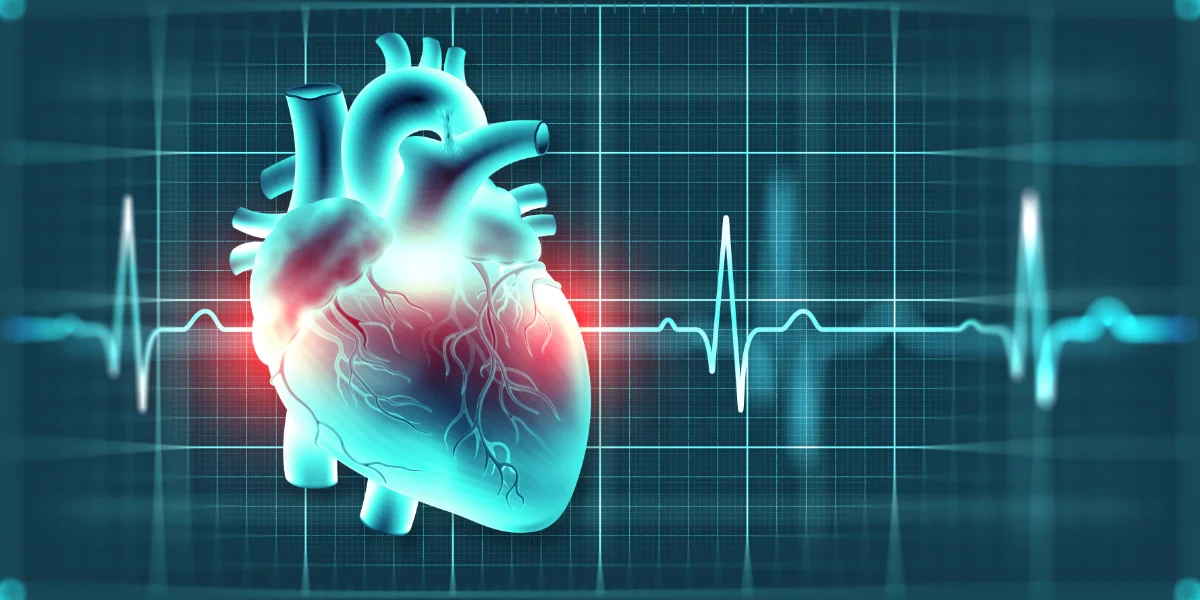 Decoding ECG Monitors: Understanding the Heart of Patient Care
